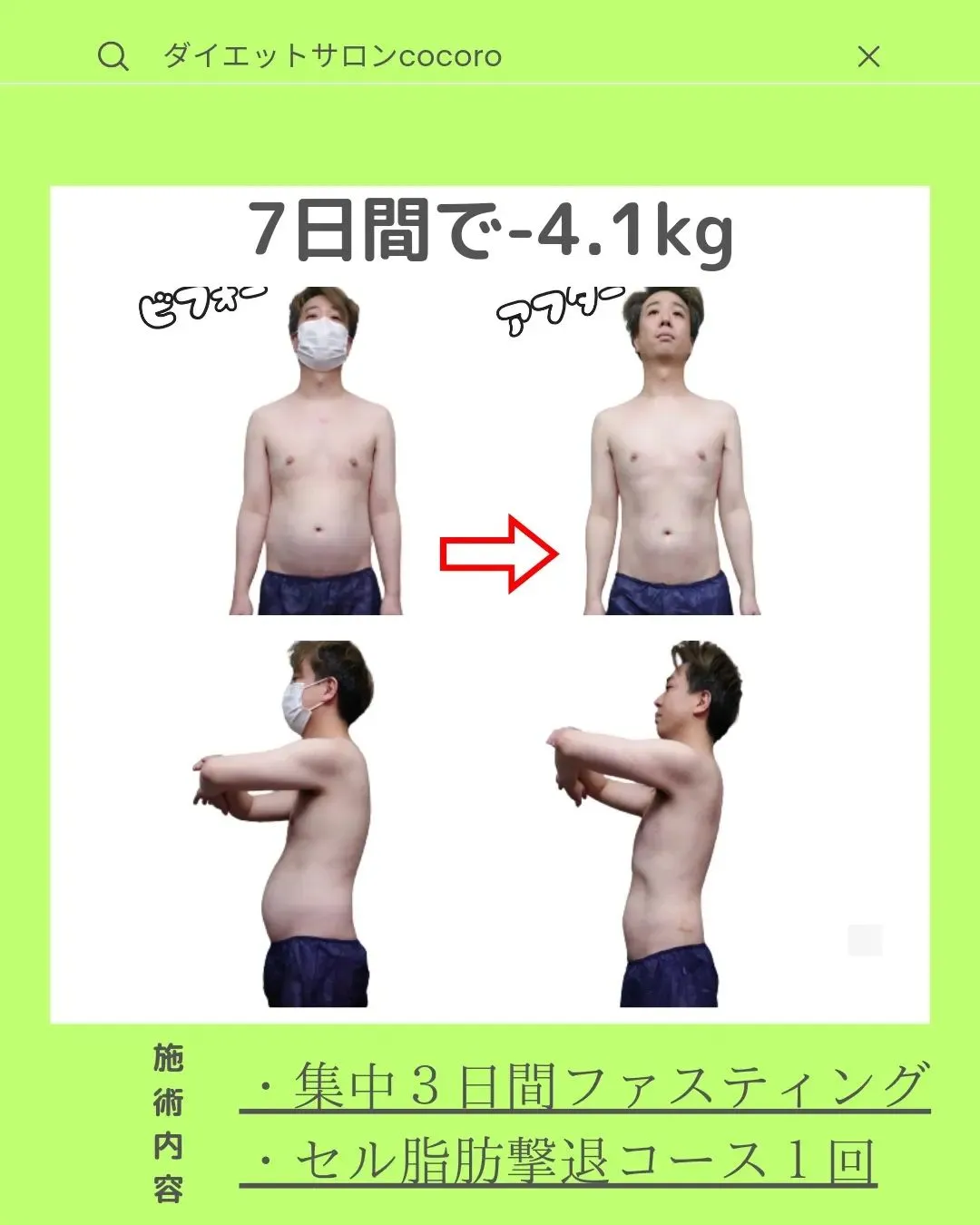 【ビフォーアフター集】@cocoro_shinjuku