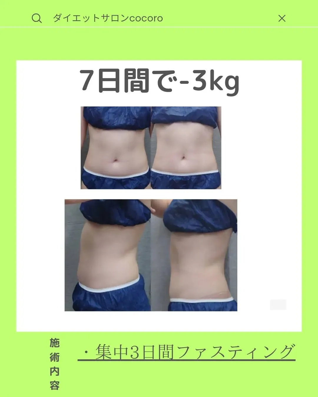 【ビフォーアフター集】@cocoro_shinjuku