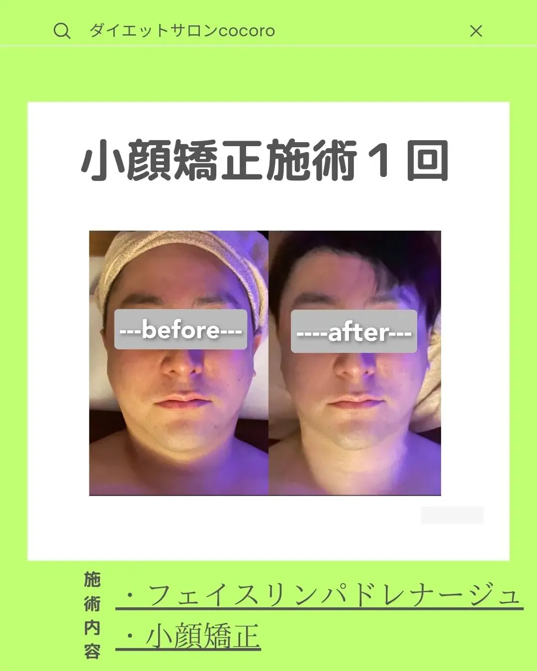 【ビフォーアフター集】@cocoro_shinjuku