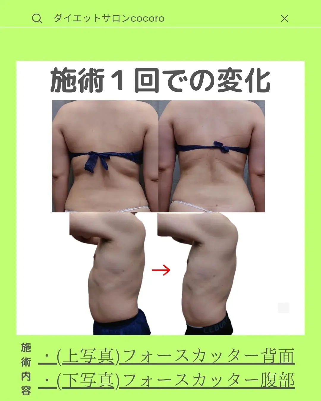 【ビフォーアフター集】@cocoro_shinjuku