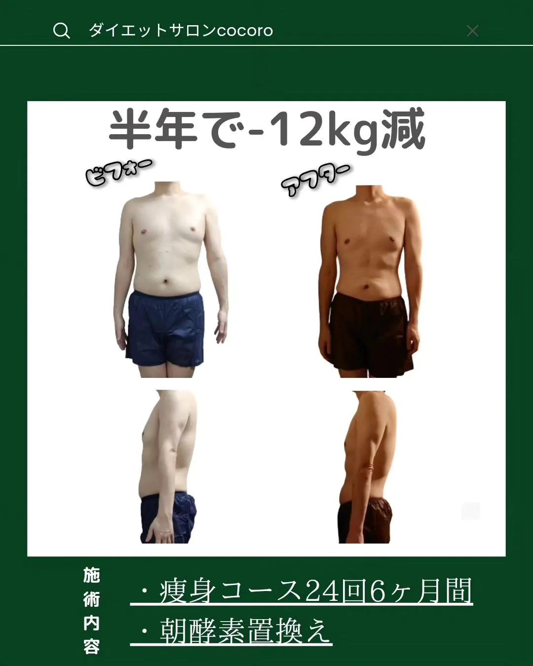 【ビフォーアフター集】