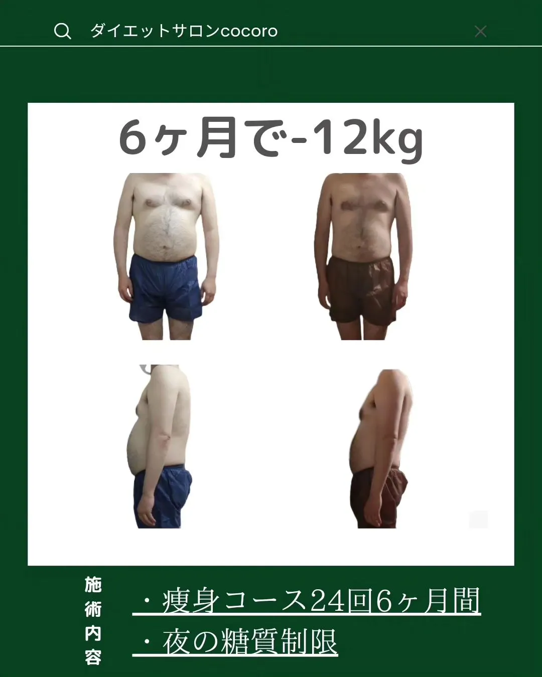 【ビフォーアフター集】