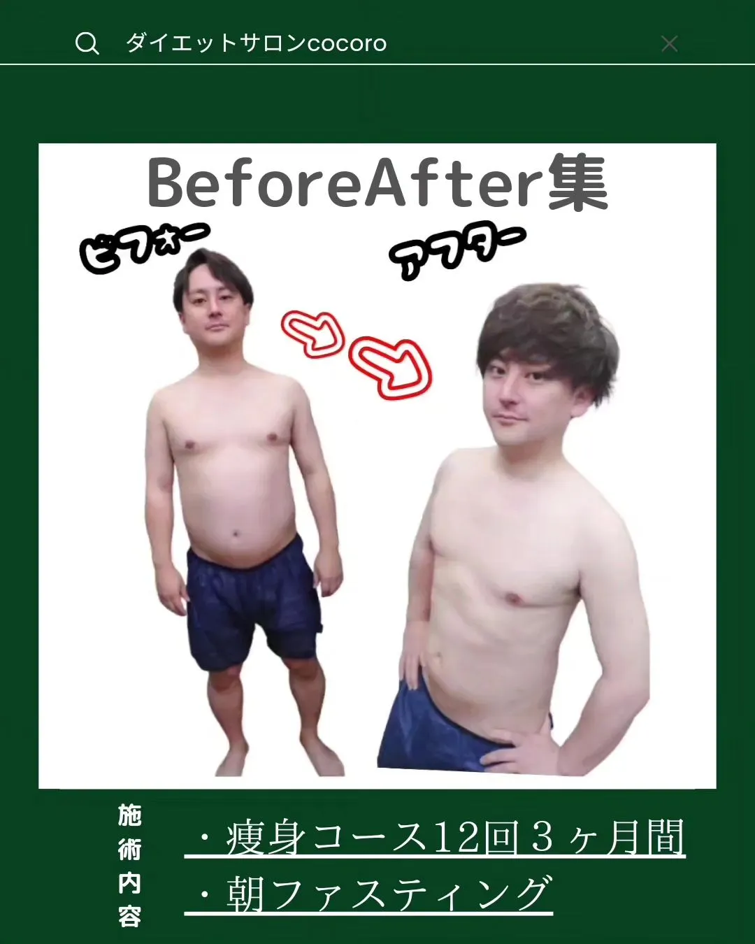 【ビフォーアフター集】