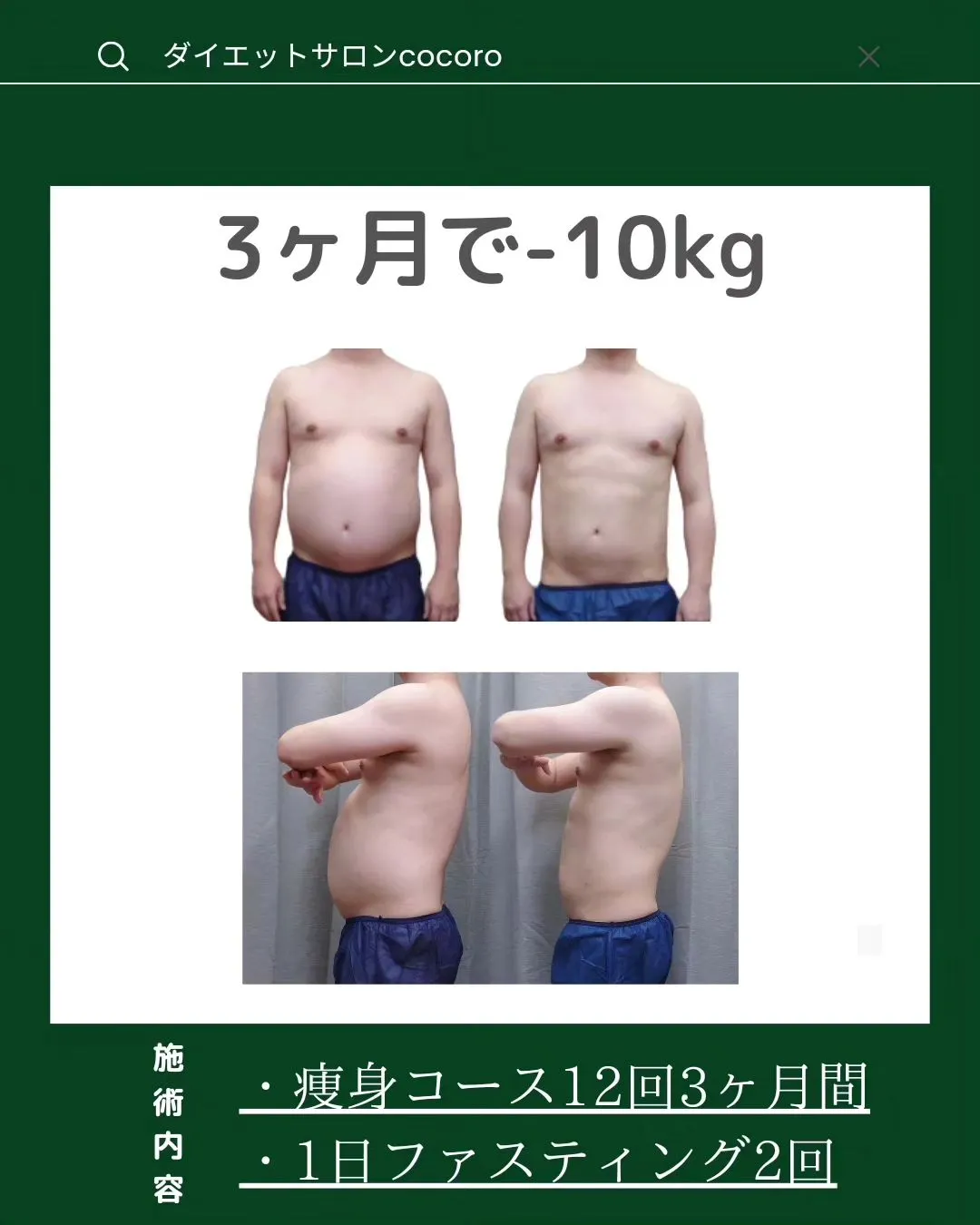 【ビフォーアフター集】