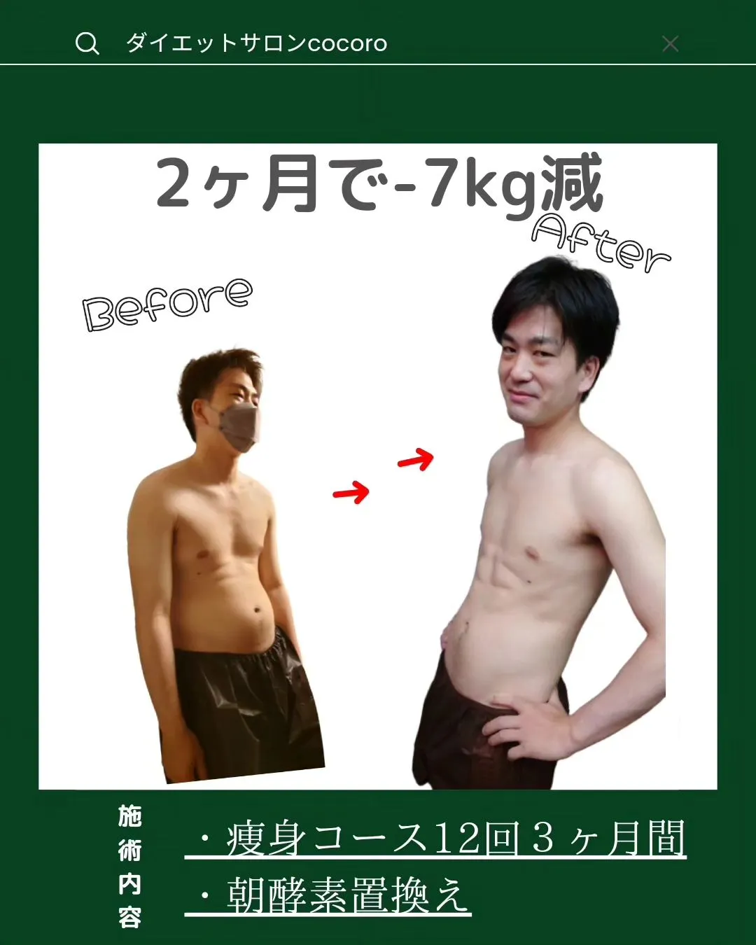 【ビフォーアフター集】