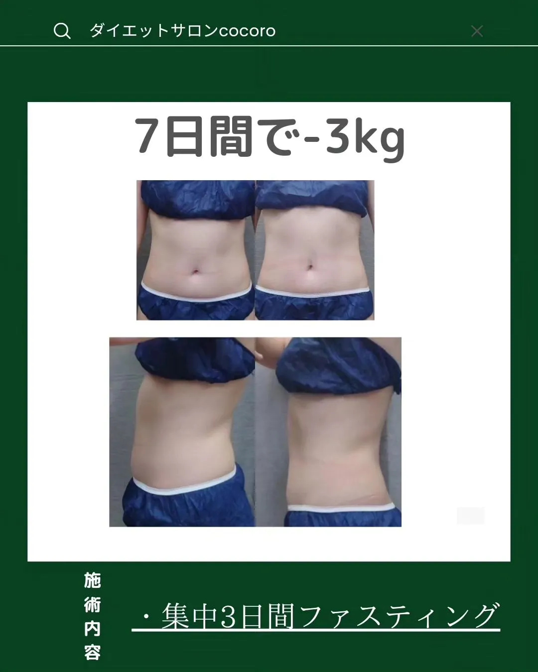 【ビフォーアフター集】