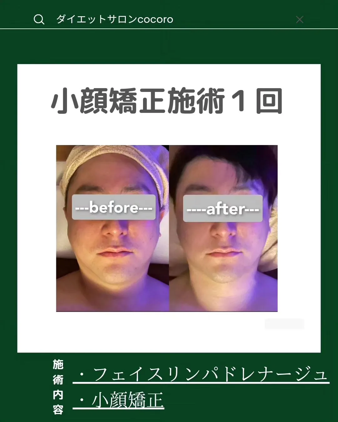 【ビフォーアフター集】