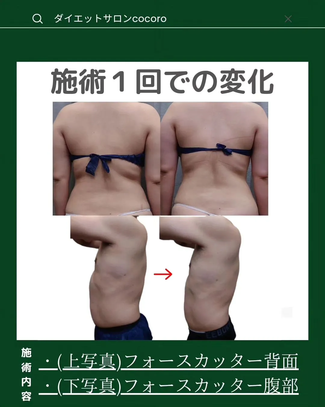 【ビフォーアフター集】