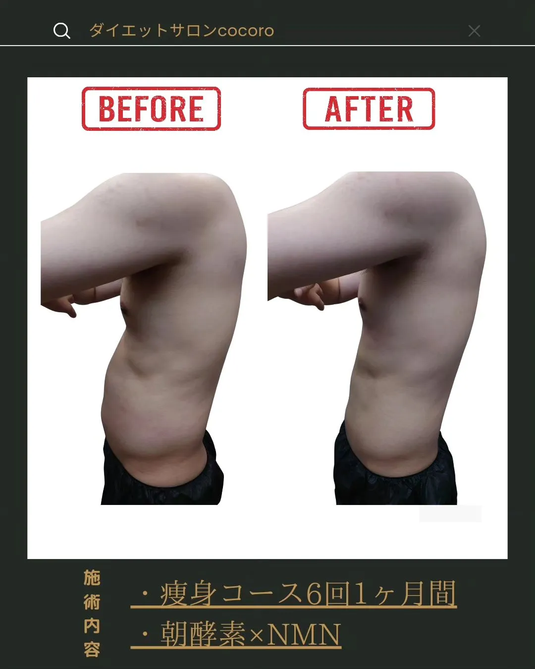 【お客様1ヶ月後のビフォーアフター】