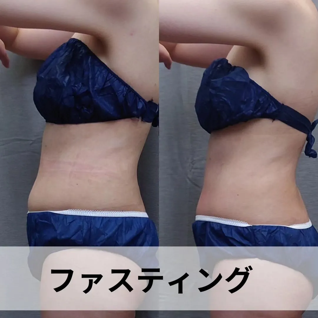 【ファスティングビフォーアフター】