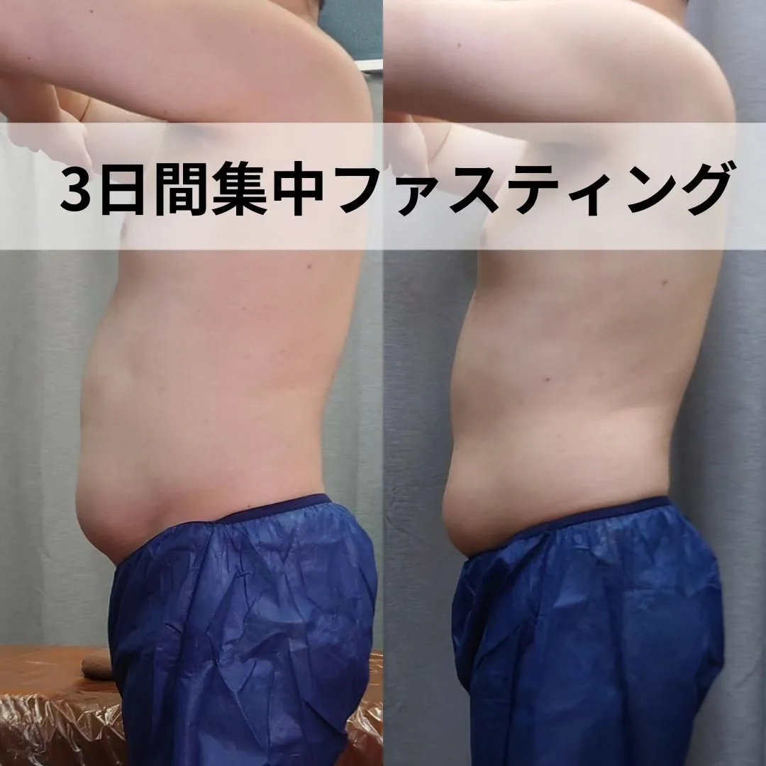 【3日間集中ファスティング】