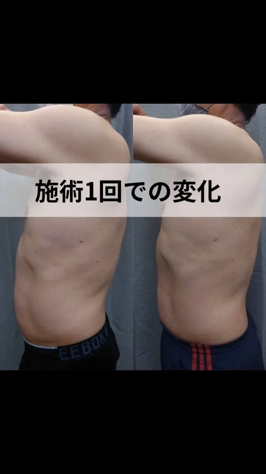 【お客様ビフォーアフター】